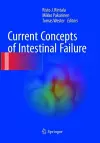 Current Concepts of Intestinal Failure cover