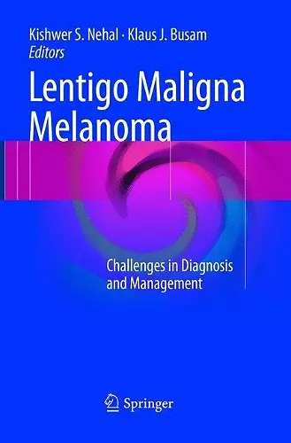 Lentigo Maligna Melanoma cover