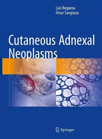 Cutaneous Adnexal Neoplasms cover
