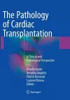 The Pathology of Cardiac Transplantation cover