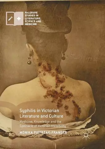 Syphilis in Victorian Literature and Culture cover