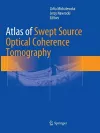 Atlas of Swept Source Optical Coherence Tomography cover