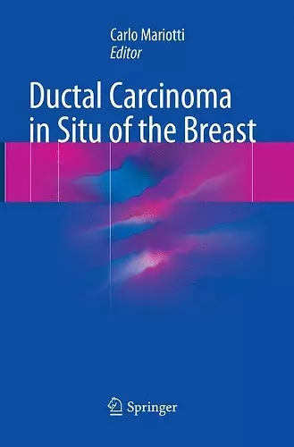 Ductal Carcinoma in Situ of the Breast cover