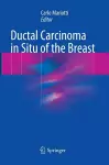 Ductal Carcinoma in Situ of the Breast cover