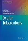 Ocular Tuberculosis cover