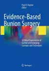 Evidence-Based Bunion Surgery cover