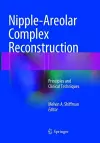 Nipple-Areolar Complex Reconstruction cover