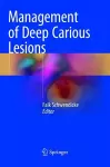 Management of Deep Carious Lesions cover