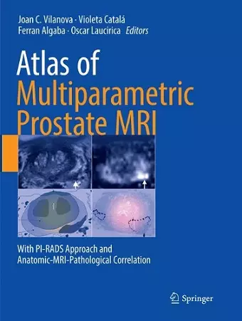 Atlas of Multiparametric Prostate MRI cover