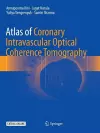 Atlas of Coronary Intravascular Optical Coherence Tomography cover