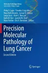 Precision Molecular Pathology of Lung Cancer cover