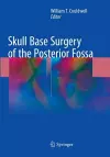 Skull Base Surgery of the Posterior Fossa cover