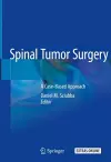 Spinal Tumor Surgery cover