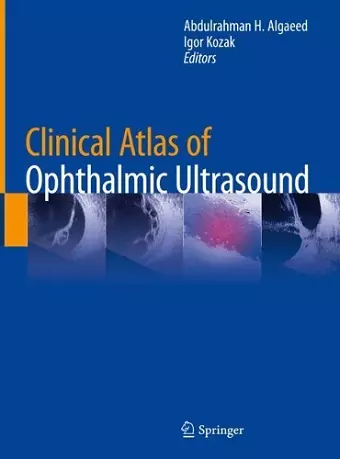 Clinical Atlas of Ophthalmic Ultrasound cover