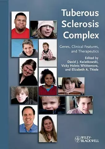 Tuberous Sclerosis Complex cover