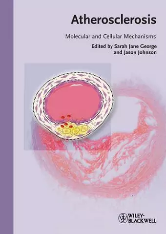 Atherosclerosis cover