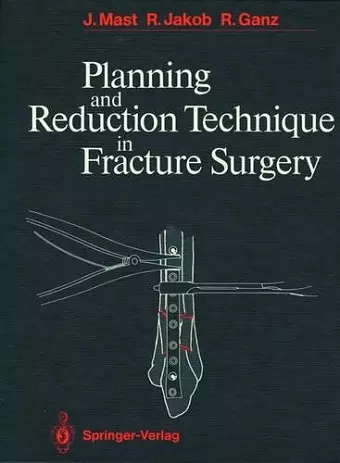 Planning and Reduction Technique in Fracture Surgery cover