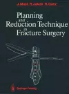 Planning and Reduction Technique in Fracture Surgery cover