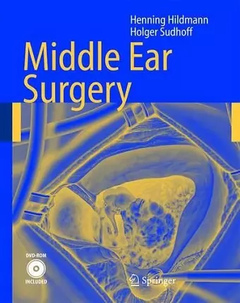 Middle Ear Surgery cover