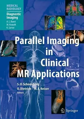 Parallel Imaging in Clinical MR Applications cover