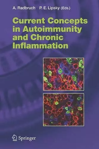 Current Concepts in Autoimmunity and Chronic Inflammation cover