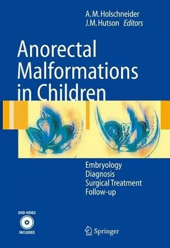 Anorectal Malformations in Children cover