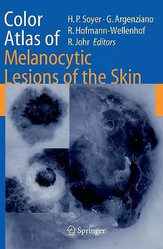 Color Atlas of Melanocytic Lesions of the Skin cover