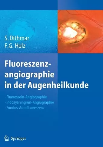 Fluoreszenzangiographie in Der Augenheilkunde cover