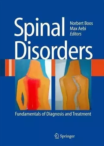 Spinal Disorders cover