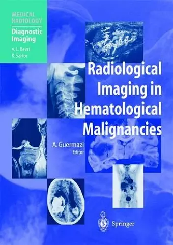 Radiological Imaging in Hematological Malignancies cover