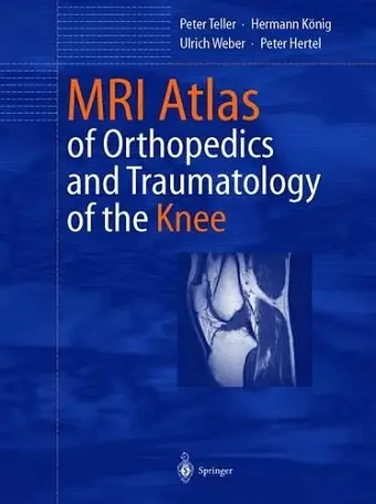 MRI Atlas of Orthopedics and Traumatology of the Knee cover