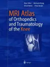 MRI Atlas of Orthopedics and Traumatology of the Knee cover
