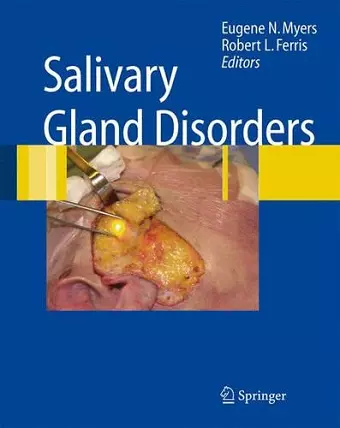 Salivary Gland Disorders cover