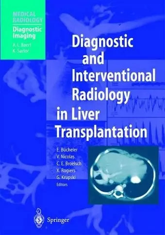 Diagnostic and Interventional Radiology in Liver Transplantation cover