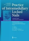 Practice of Intramedullary Locked Nails cover