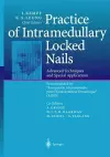 Practice of Intramedullary Locked Nails cover