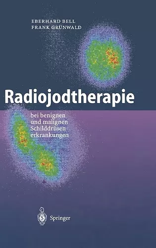 Radiojodtherapie cover