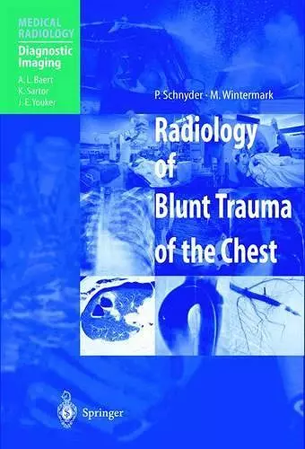 Radiology of Blunt Trauma of the Chest cover