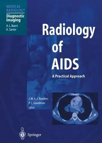 Radiology of AIDS cover