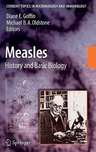 Measles cover