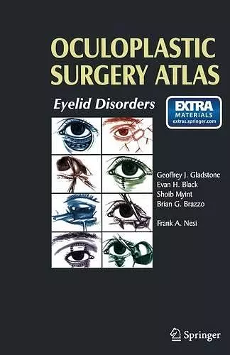 Oculoplastic Surgery Atlas cover