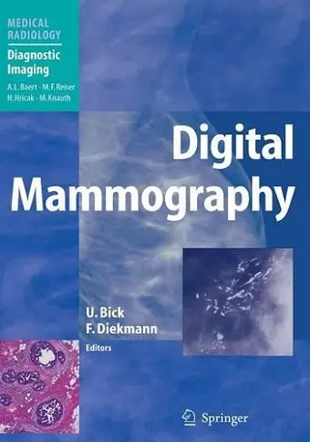 Digital Mammography cover