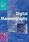 Digital Mammography cover