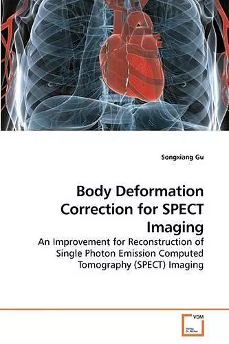 Body Deformation Correction for SPECT Imaging cover