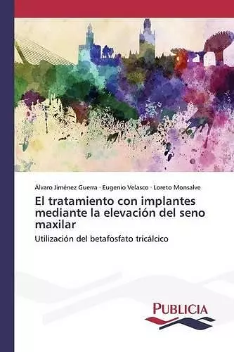 El tratamiento con implantes mediante la elevación del seno maxilar cover