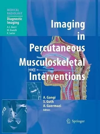 Imaging in Percutaneous Musculoskeletal Interventions cover