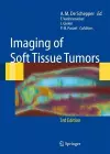 Imaging of Soft Tissue Tumors cover