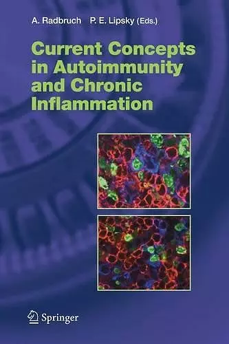 Current Concepts in Autoimmunity and Chronic Inflammation cover