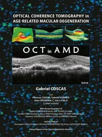 Optical Coherence Tomography in Age-Related Macular Degeneration cover