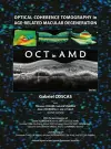 Optical Coherence Tomography in Age-Related Macular Degeneration cover